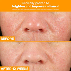 Paula's Choice C15 Super Booster