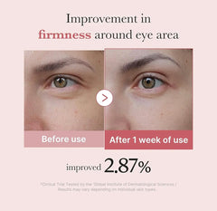 كريم العيون الوردي الببتيد من ميديكيوب PDRN