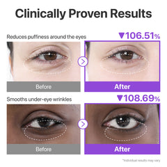 Numbuzin - NMN collagen under eye patches