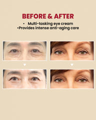 كريم العيون K-SECRET SEOUL 1988، ليبوسوم الشبكية 4% + حبوب مخمرة