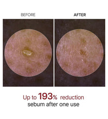 Dr.Melaxin Peel Shot Glow Black Rice Peeling Ampoule