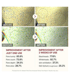 Dr.Melaxin Peel Shot Glow Black Rice Peeling Ampoule