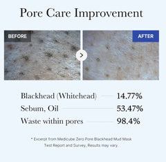 قناع الطين ميديكيوب زيرو بور للرؤوس السوداء