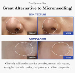 Medicube One Day Exosome Shot  2000