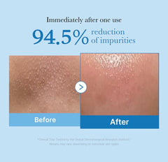 Medicube zero pore blackhead deep cleansing oil