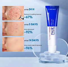 LION Pair Acne Cream