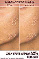 سيروم شارلوت تيلبوري لتصحيح البقع الداكنة وإشراقة البشرة (حجم العينة)