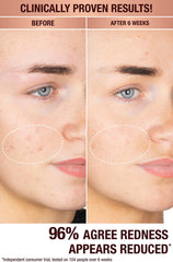 سيروم شارلوت تيلبوري لتصحيح البقع الداكنة وإشراقة البشرة (حجم العينة)