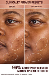 سيروم شارلوت تيلبوري لتصحيح البقع الداكنة وإشراقة البشرة (حجم العينة)