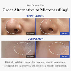 Medicube One Day Exosome Shot 2000 Serum (Sample size)