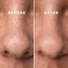 سائل COSRX اثنان في واحد بدون مسام قوي