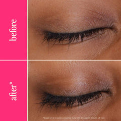 سيروم الرموش الكبير