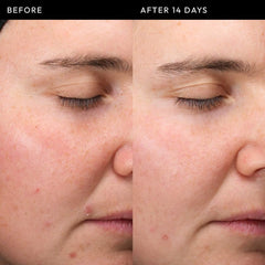 The INKEY List Exosome Hydro-Glow Complex Serum (sample size)