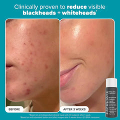 Paula's Choice-Exfoliation Icons Kit