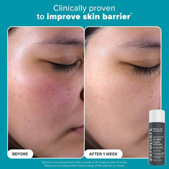 Paula's Choice-Exfoliation Icons Kit