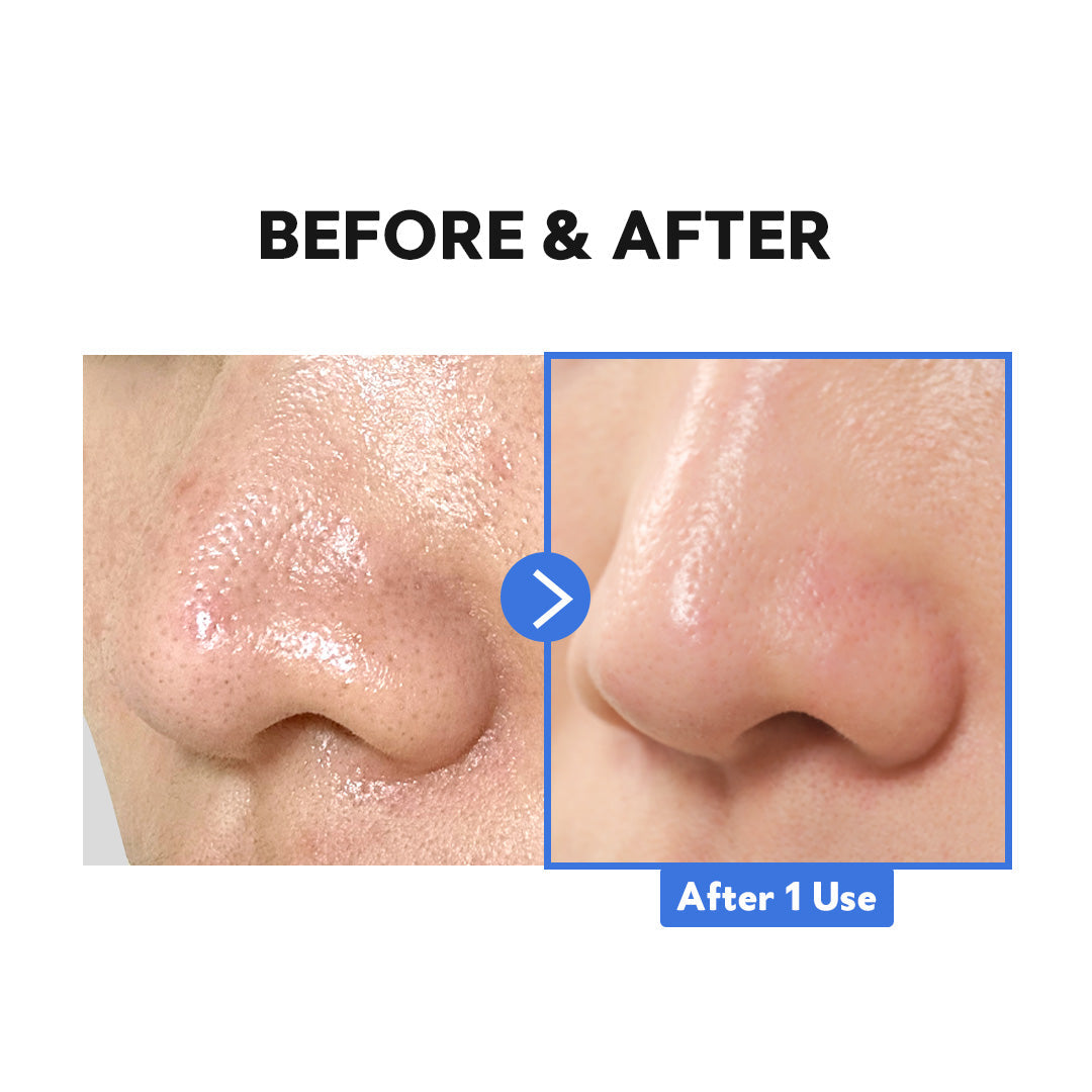 Tirtir Hydro Boost Enzyme Cleansing Balm Makeup Remover