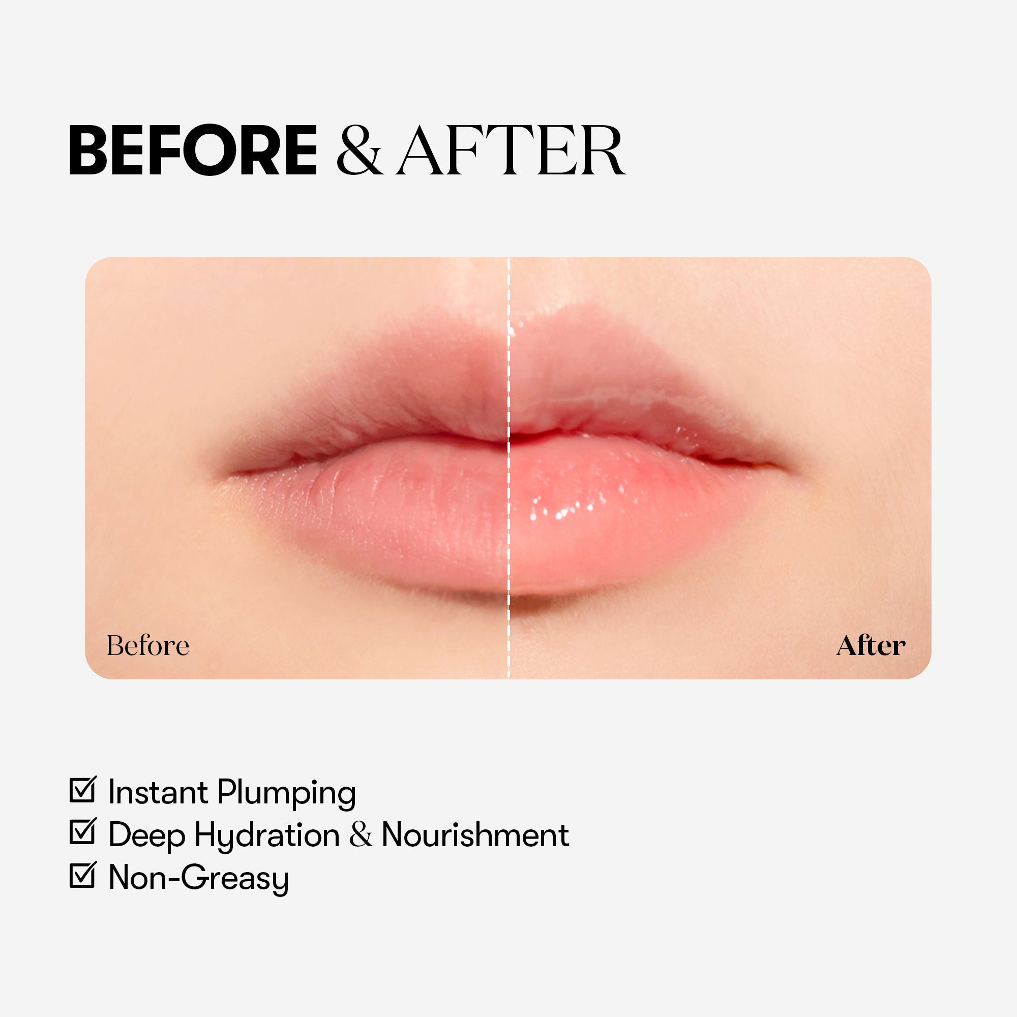 VT COSMETICS Reedle Shot Lip Plumper – Beginner