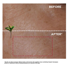 Clarins Super Restorative Day Cream — Very Dry Skin