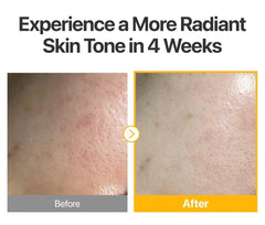 NUMBUZIN No.5 Glutathione Vitamin Concentrated Mask