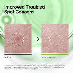 ANUA Azelaic 3+ Cica Skin Clarifying Toner