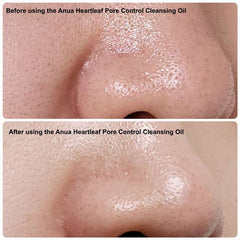 Anua Heartleaf Pore Control Cleansing Oil