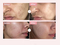 Medicube PDRN MINI Glow Kit