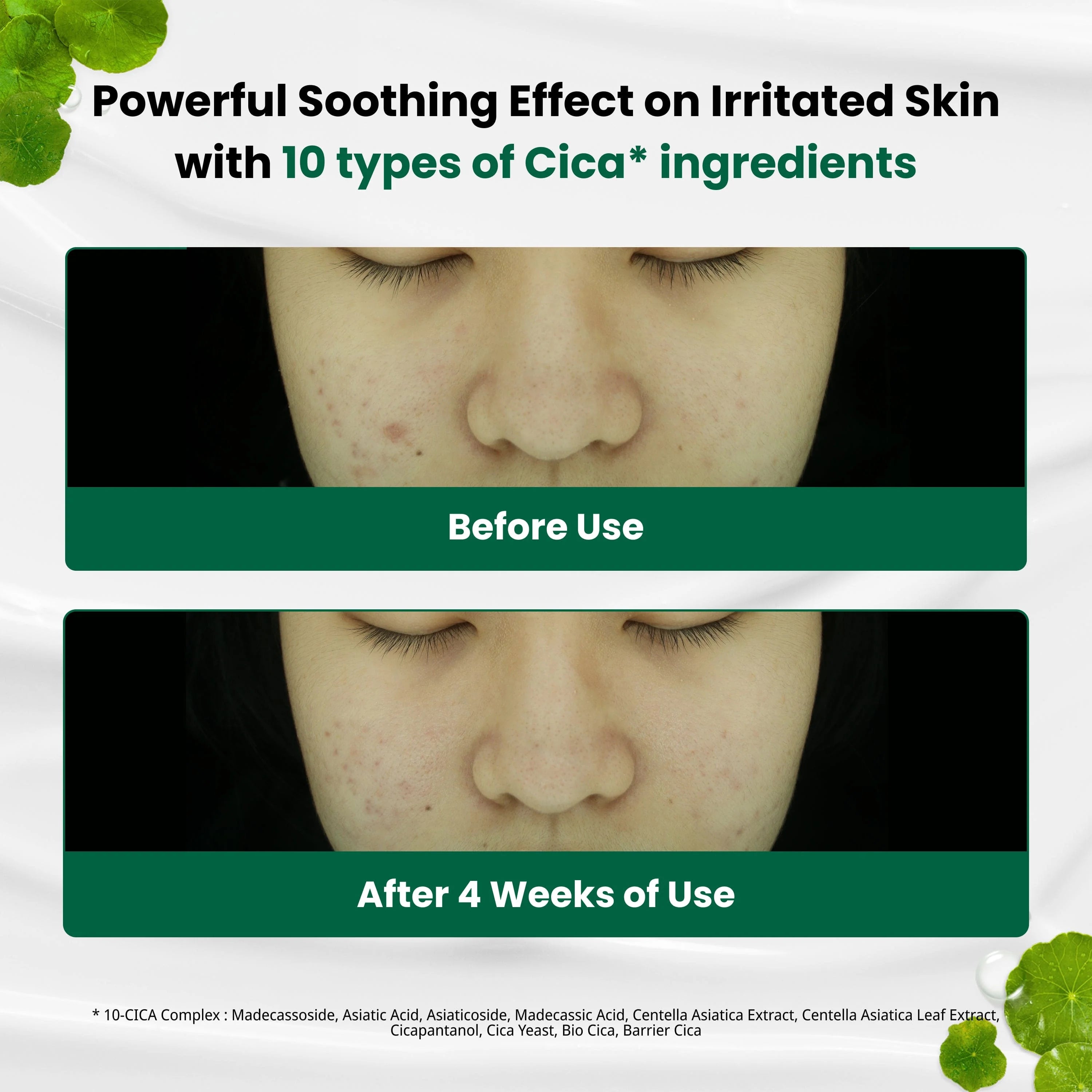 DR.G R.E.D BLEMISH CLEAR SOOTHING CREAM