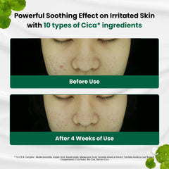 DR.G R.E.D BLEMISH CLEAR SOOTHING CREAM