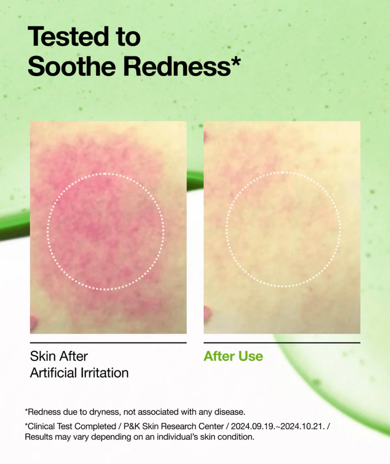 Anua Azelaic Acid 10+ Hyaluron Redness Soothing Serum