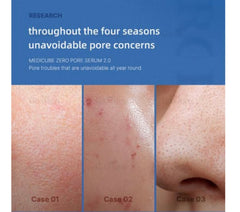 Medicube zero pore serum 2.0