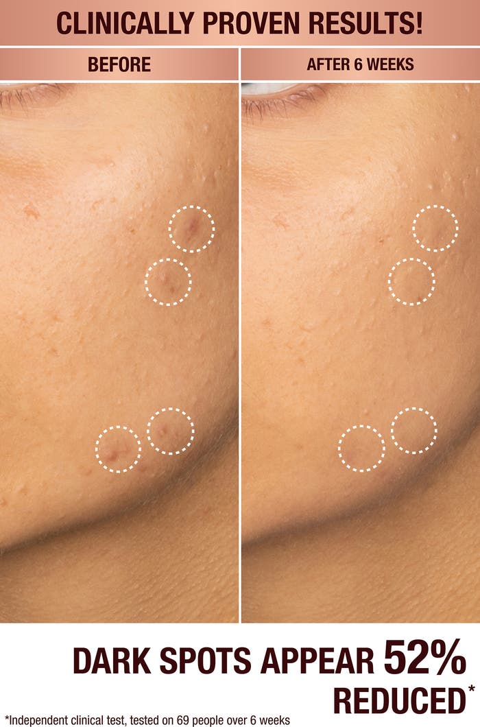 Charlotte Tilbury Dark Spot Correcting Radiance Serum (sample size)