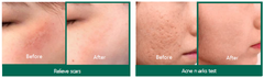 Some By Mi Snail Truecica Miracle Repair Serum