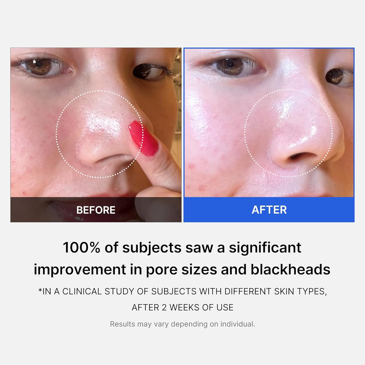 Medicube Zero Pore Pads