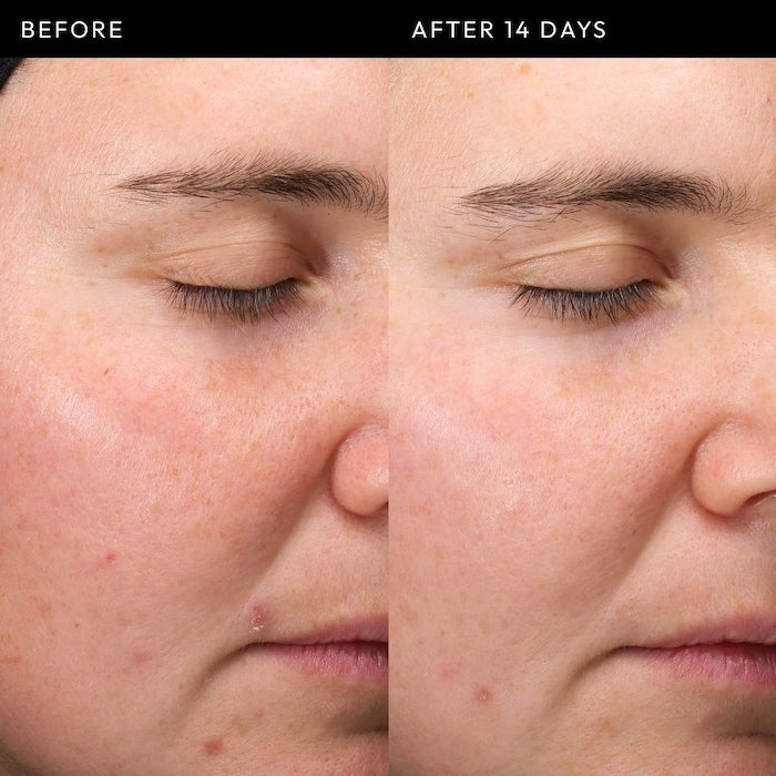 The INKEY List Exosome Hydro-Glow Complex Serum (sample size)